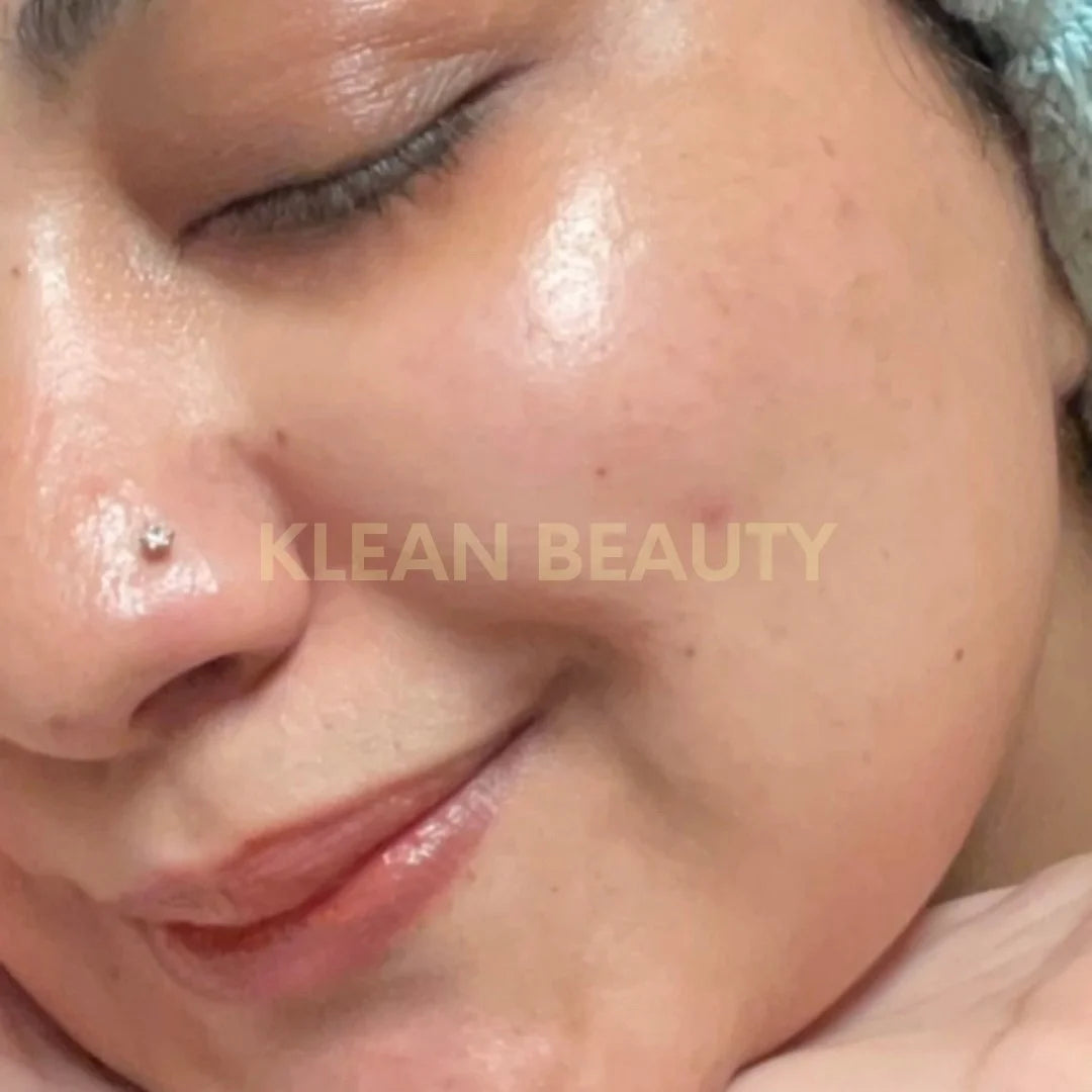 Hydrating Moisturizer π