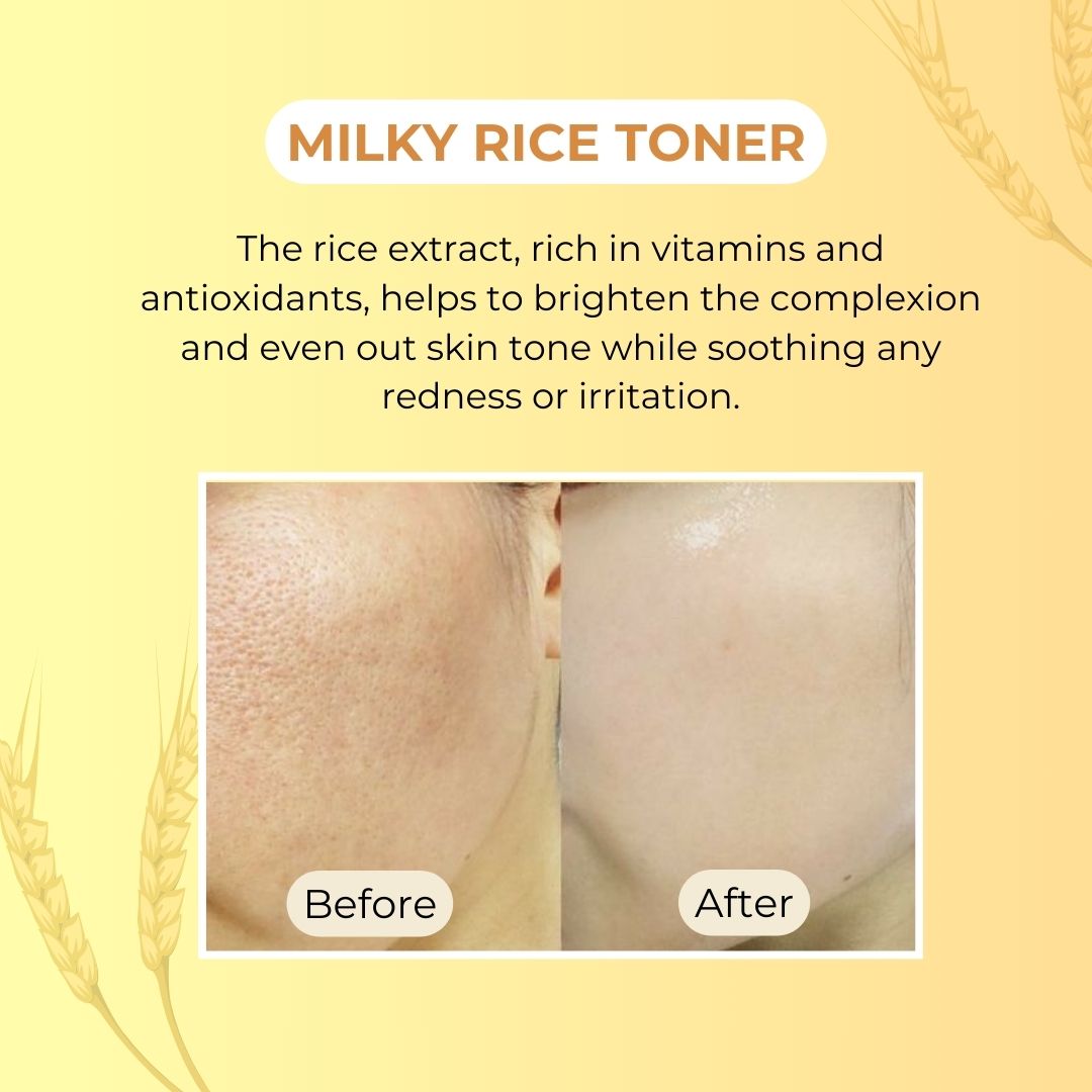 Milky Toner๐ฅ๐