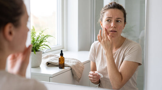 Why Does Glycolic Acid Burn? Causes, Prevention & When to Stop Using It
