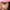 Ageing Pigmentation Skin